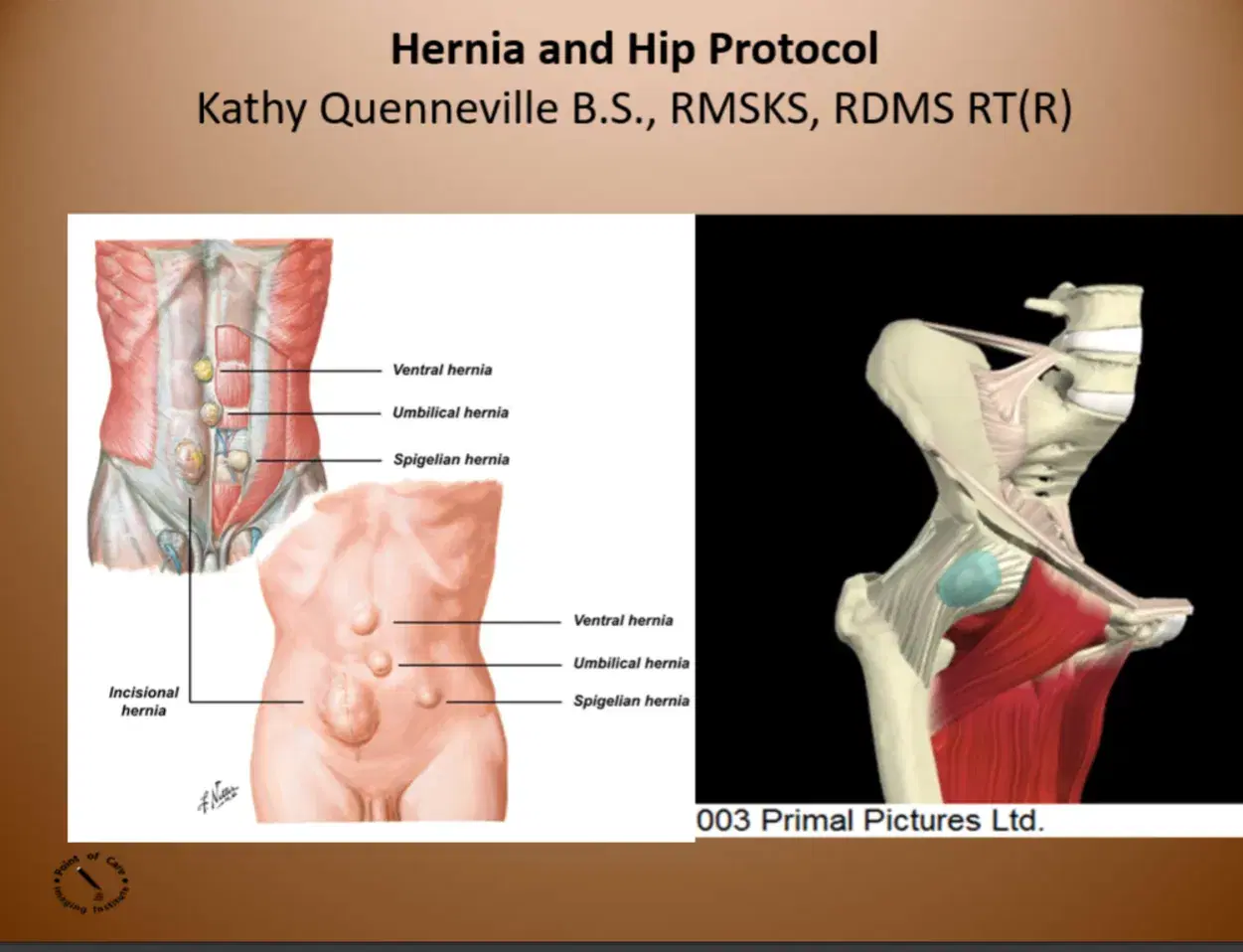 The Complete Hip and Groin Protocol for Ultrasound