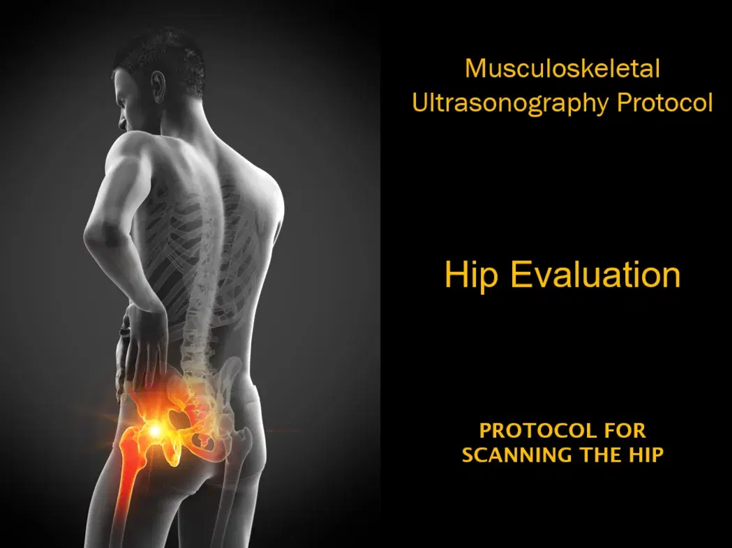 Point of Care Hip Ultrasound