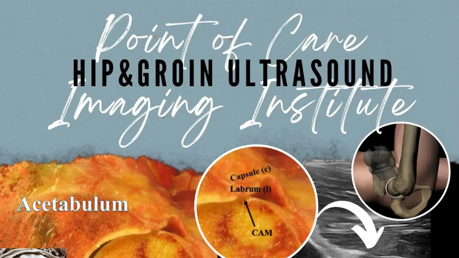 Point of Care Imaging Institute Spring 2025: Hip & Groin Ultrasound
